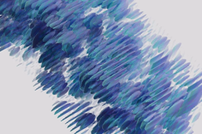 Based Speech Restoration Technology